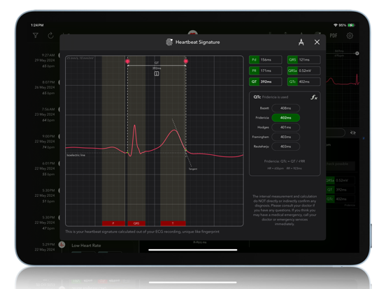 Screenshot #5 pour ECG+ | Analyse QTc, HRV & FA