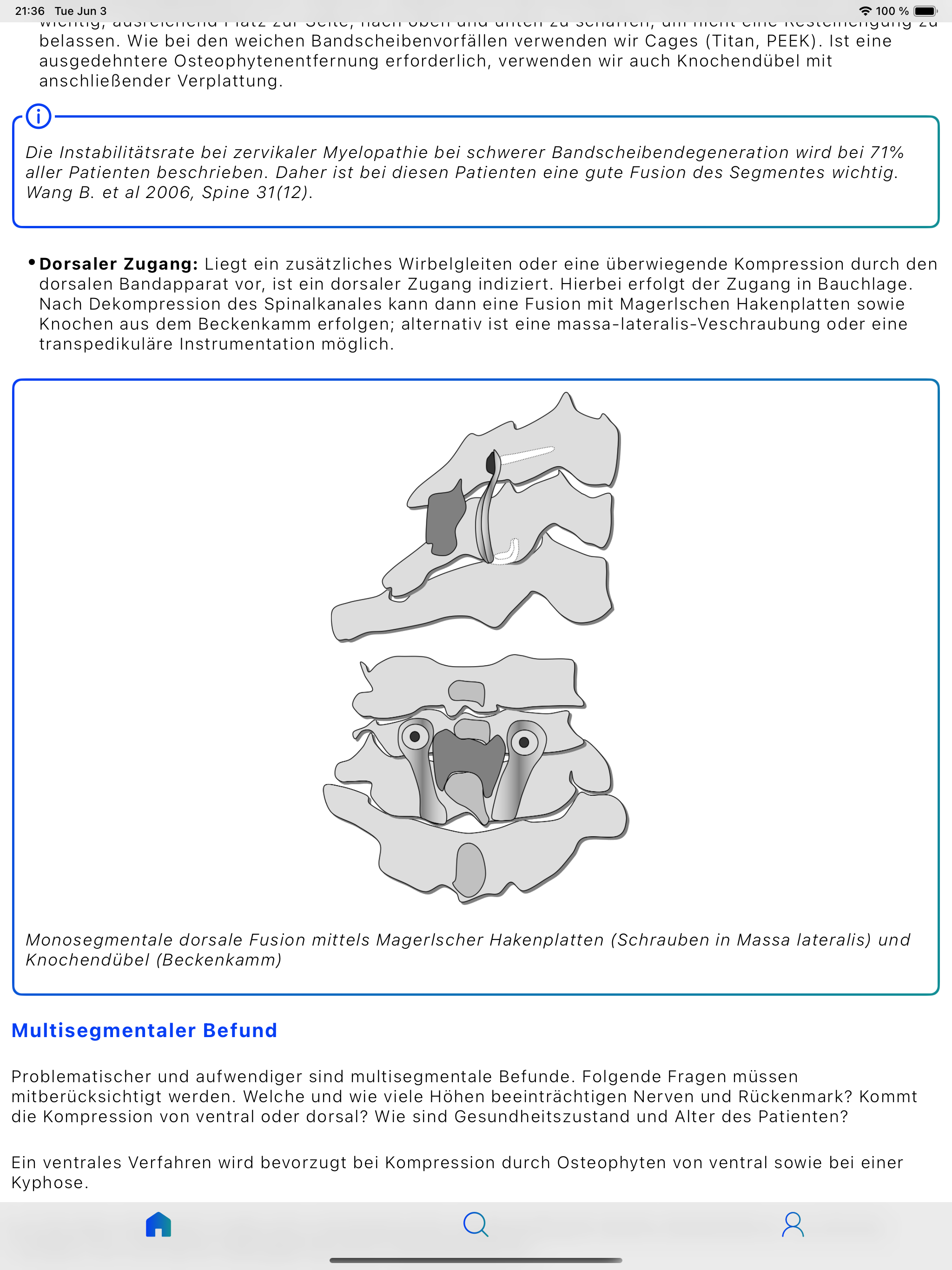 SpineGuide