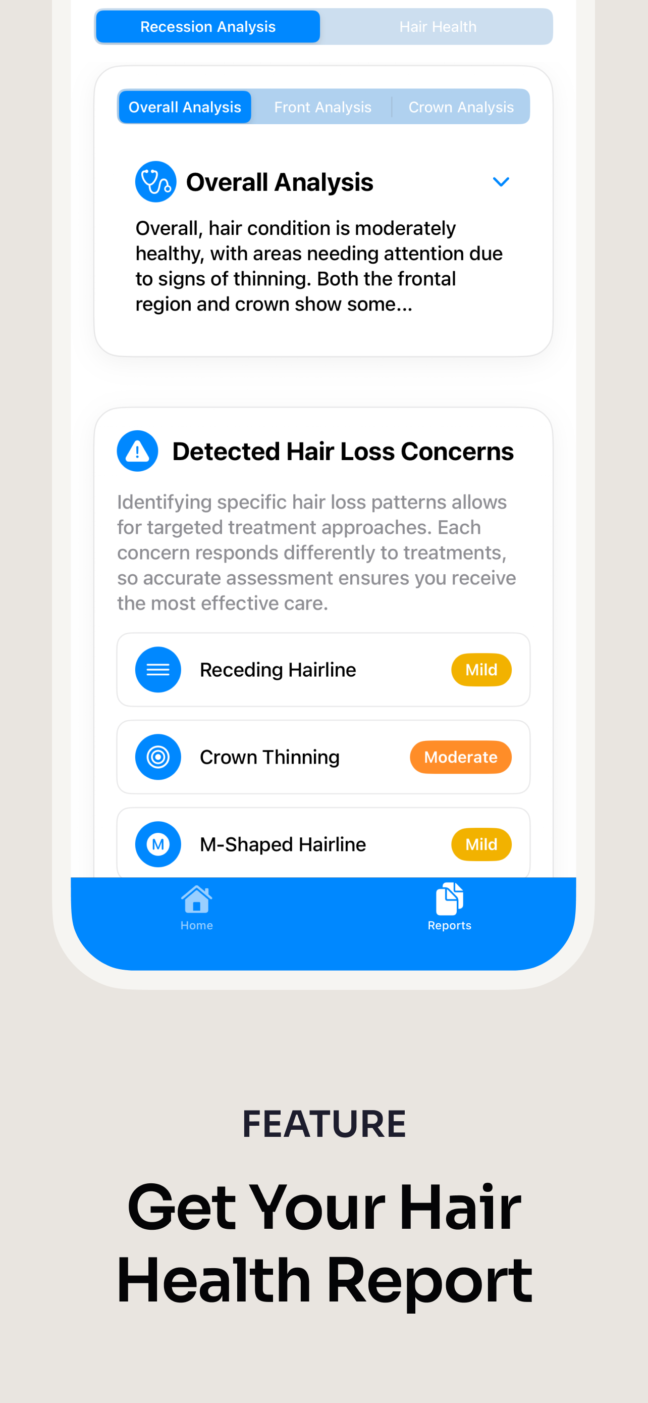 Hairly: Hair Health AI Scanner