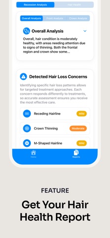 Hairly: Hair Health AI Scanner screenshot