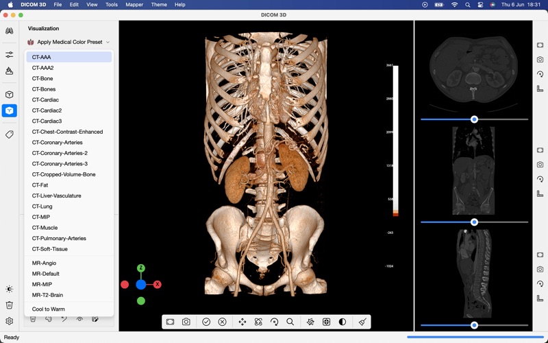 DICOM 3D Screenshot