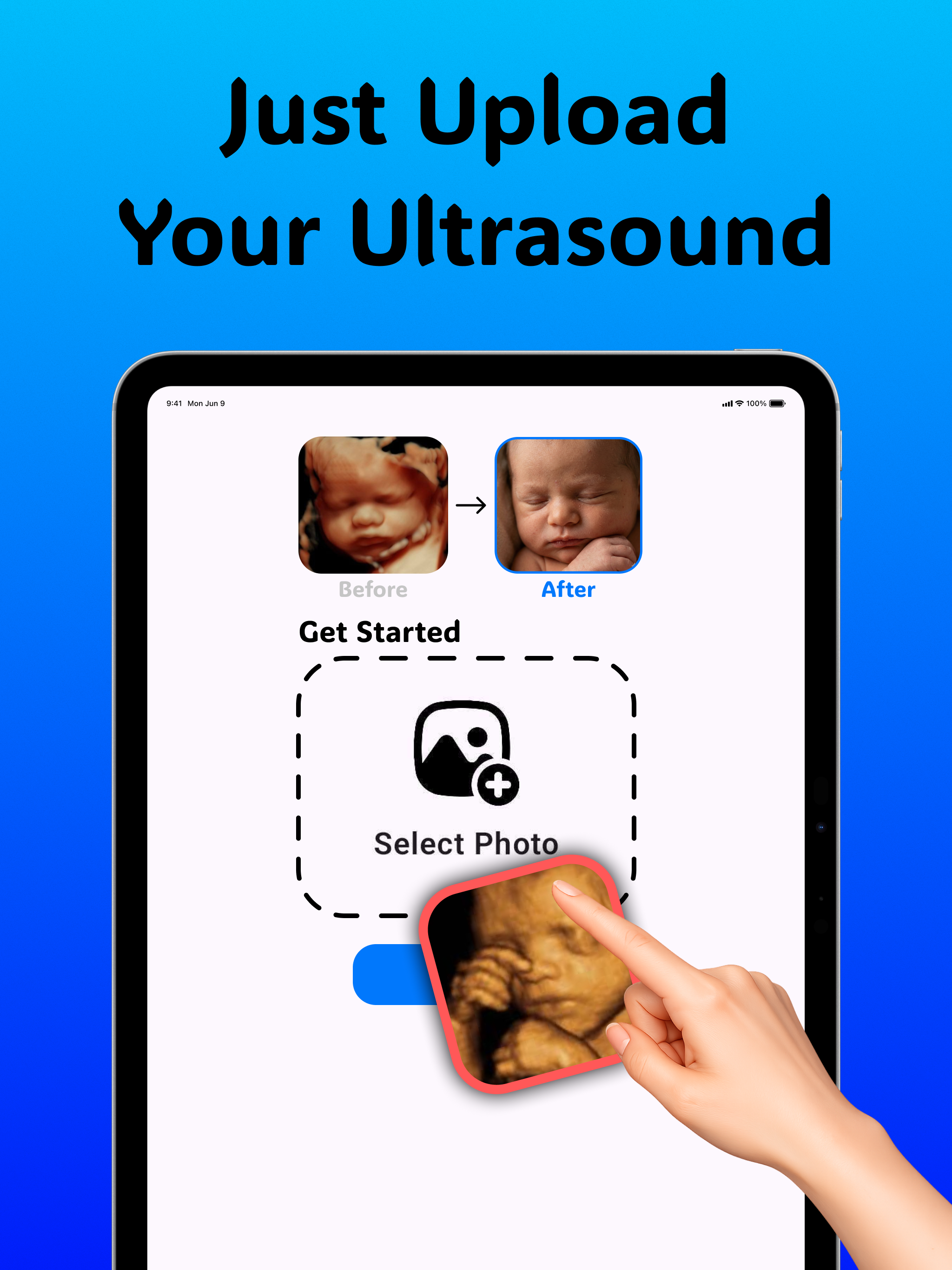 Ultrasound to Photo: BabyGuess