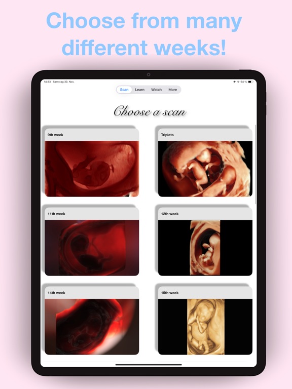 ScanBaby learn baby ultrasound iPad screenshot 4 - Medical app