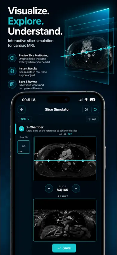 MyoScan IQ: Cardiac MRI Guide screenshot 2