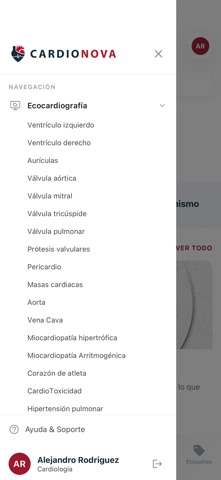 CardioNova screenshot