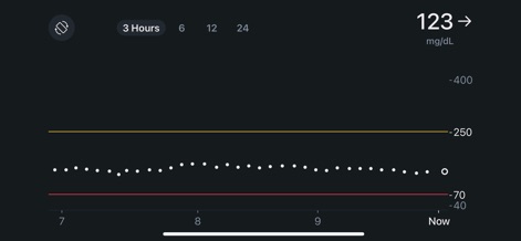 Dexcom Follow - The dark theme enhances data readability by clearly presenting current 'mg/dL' glucose values and critical high and low threshold lines on the graph, reducing eye strain.