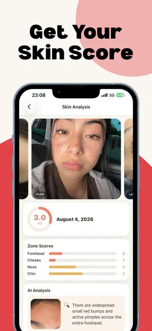 AcneFix - Get rid of Acne screenshot 2