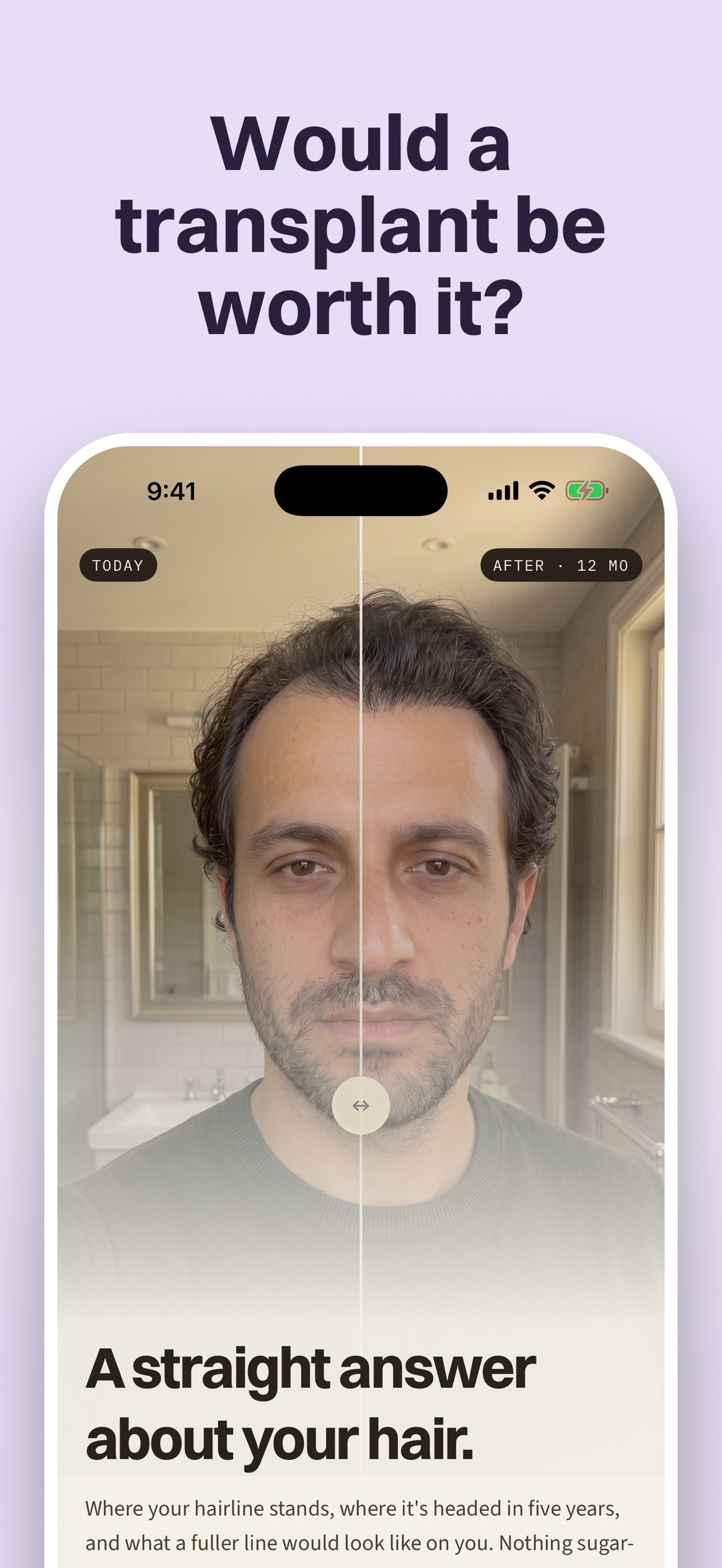 Screenshot 2 of Replant: Hair Transplant Truth
