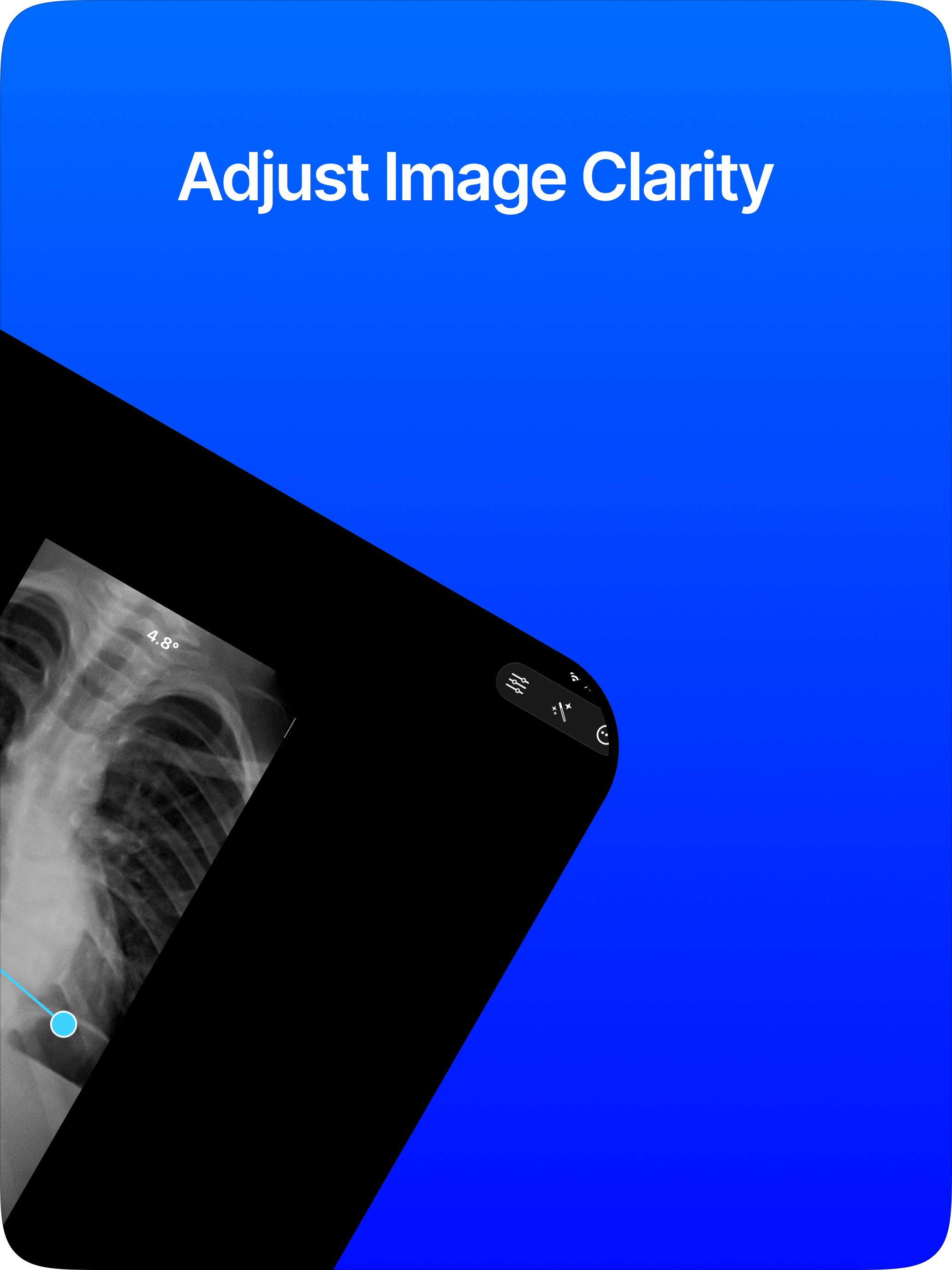 Cobb Angle Pro Spine X-Ray