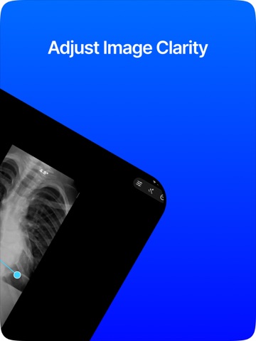 Cobb Angle Pro Spine X-Ray iPad screenshot