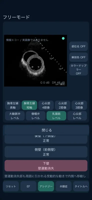 心エコートレーニング screenshot 2 of 6