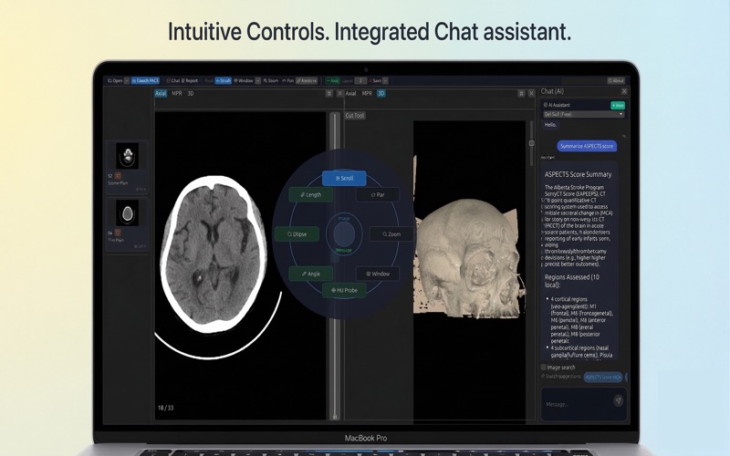 Donut DICOM Viewer screenshot
