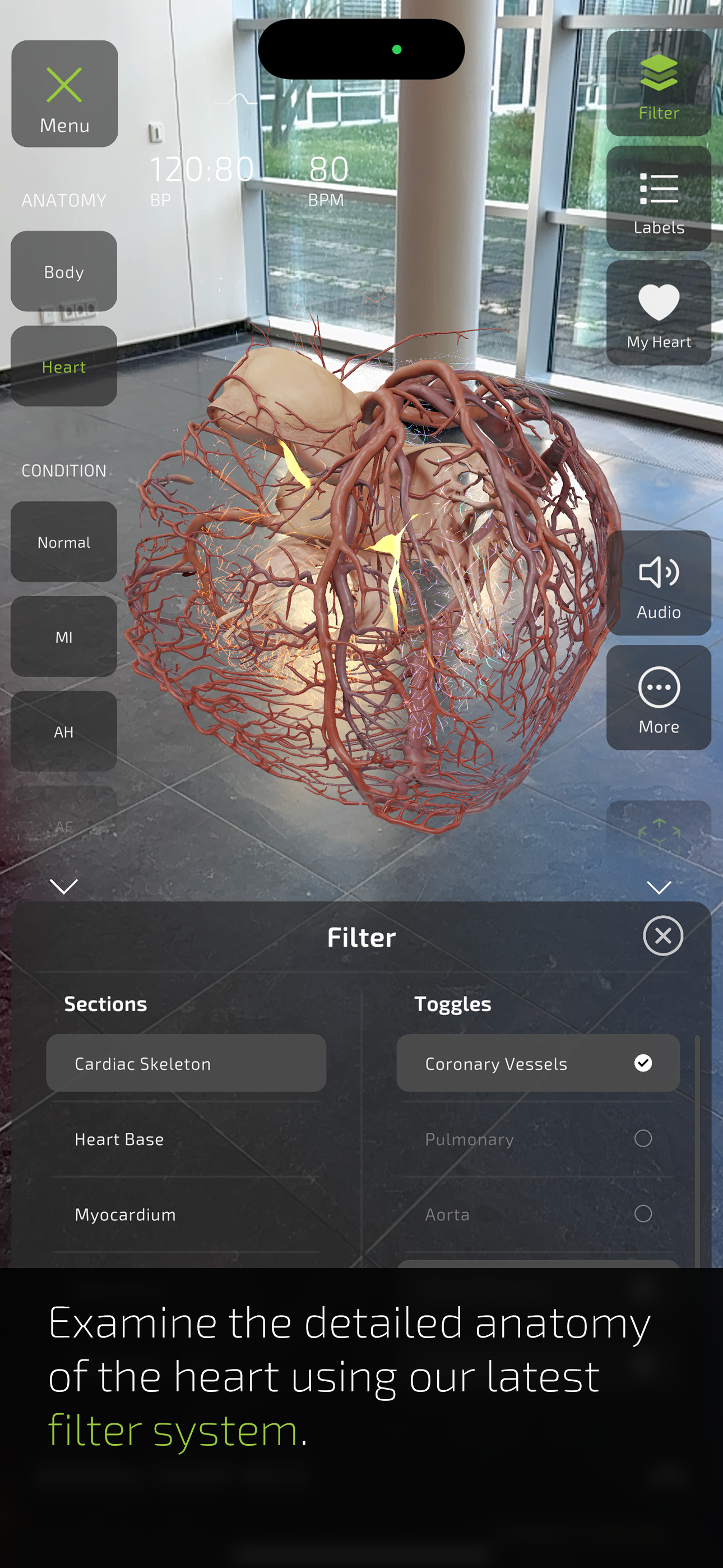 INSIGHT HEART