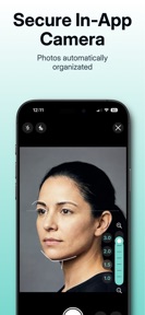 GlowPro MD: Before & After screenshot