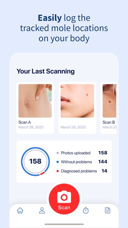 AI Dermatologist: Skin Scanner