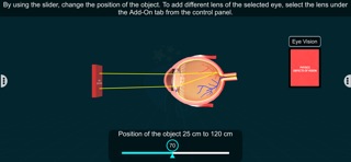Vision Defects – EduTech Era iPhone screenshot