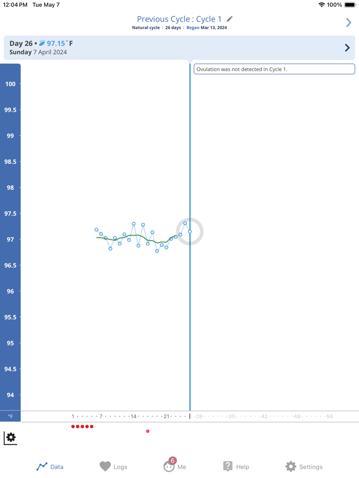 OvuSense Cycle  PCOS Tracker