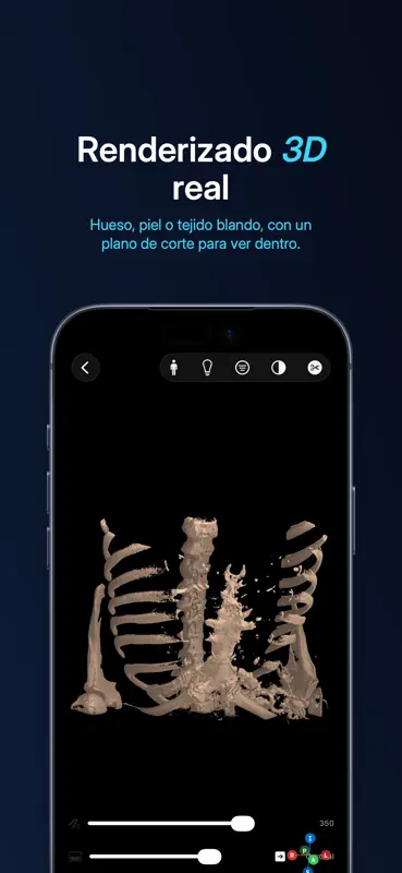 Lumen — Visor DICOM screenshot 2 of 7