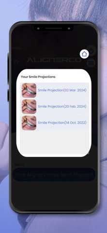 Aligner Track screenshot
