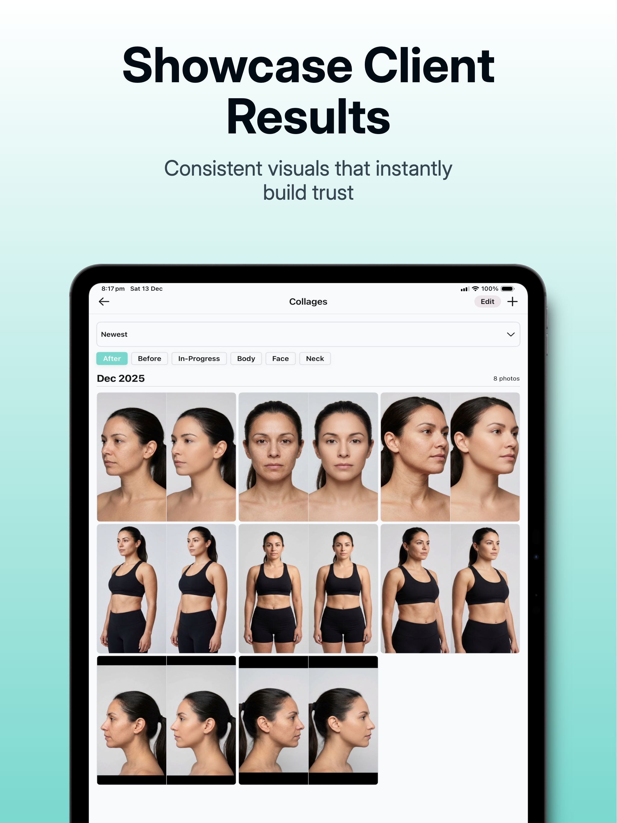 GlowPro MD: Before & After screenshot 9