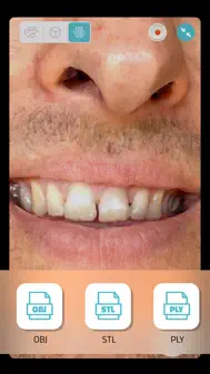 Qlone Dental Pro 3D Scanner iphone bilder 2