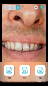Qlone Dental Pro 3D Scanner screenshot
