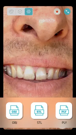 Скриншот Qlone Dental Pro 3D Scanner на iPhone 3