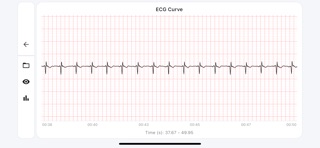 ECG Suite screenshot