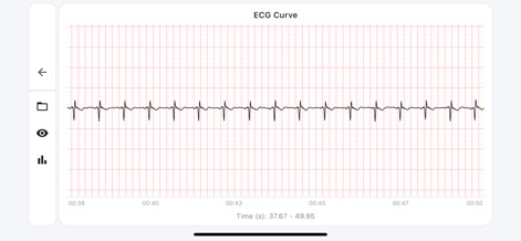 ECG Suite - App de Salud y forma física | MWM