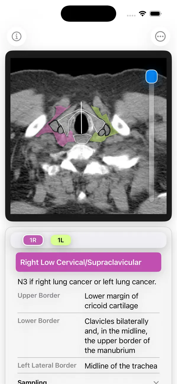 Screenshot #1 pour Thoracic Lymph Node Map