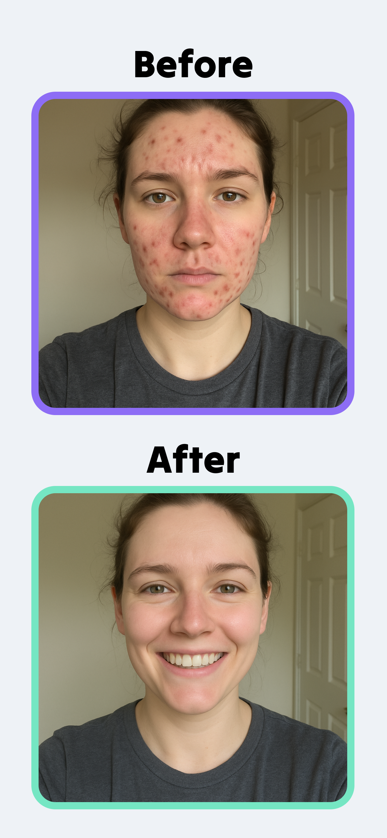 Skincare Scan - Sana screenshot 8