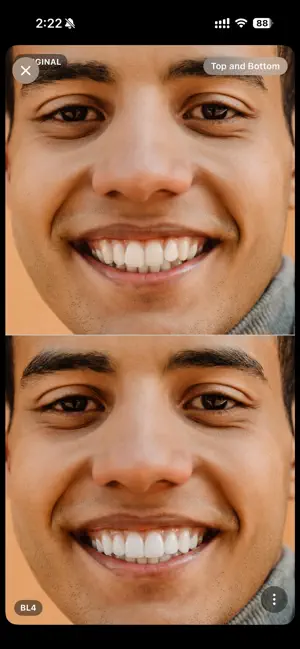 Bleach Dental screenshot 4