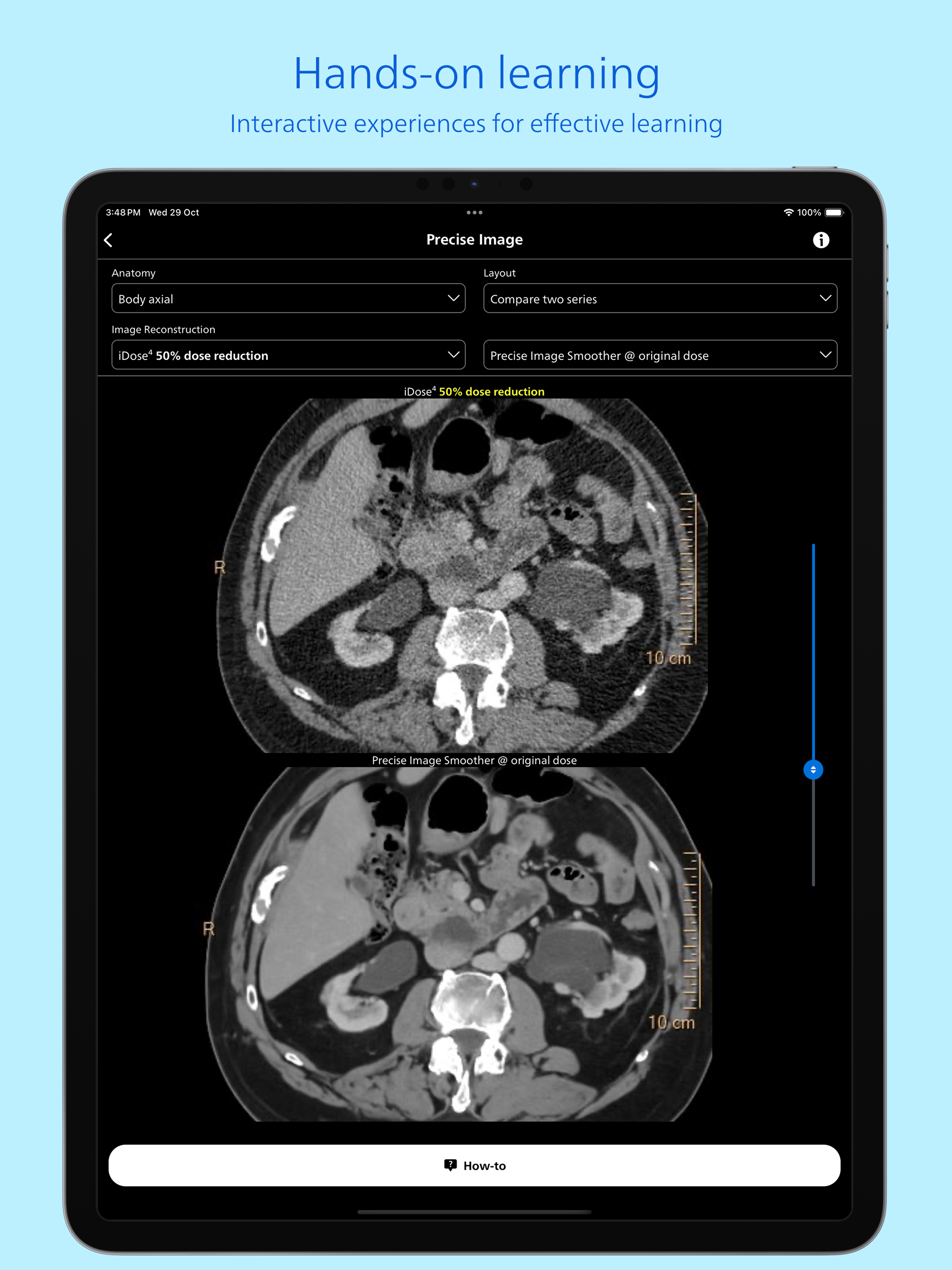 Philips CT Learning screenshot 14