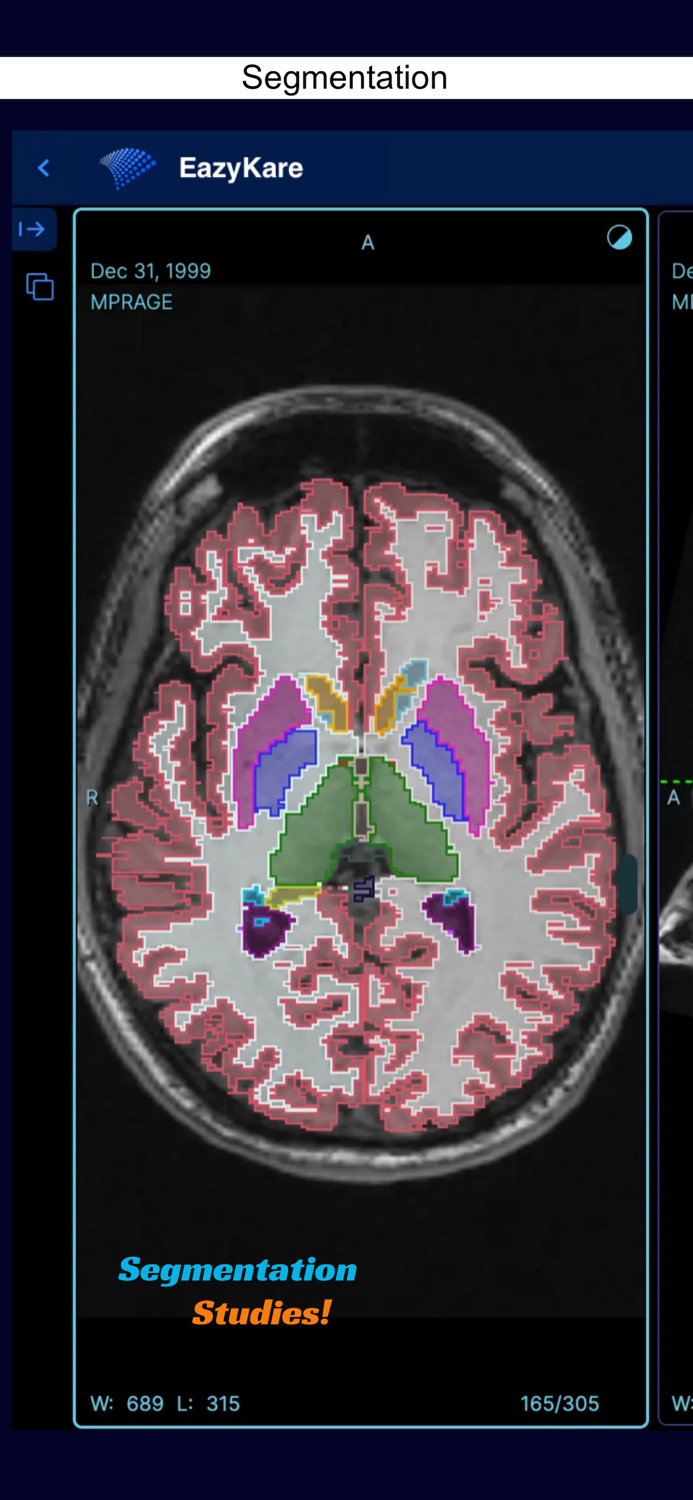 EazyGo  Easy PACS  DICOM