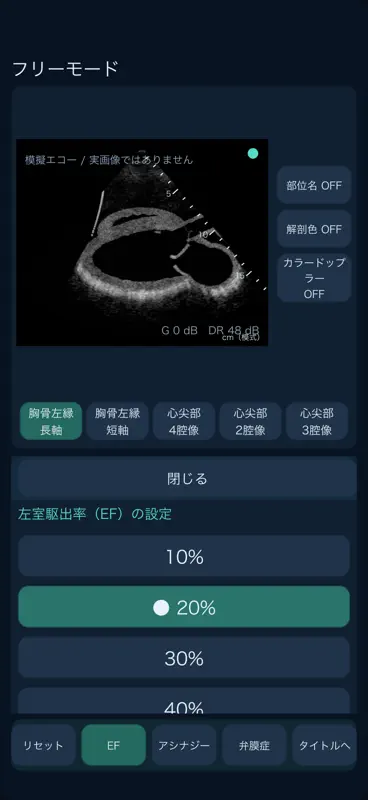 心エコートレーニング screenshot 4 of 6