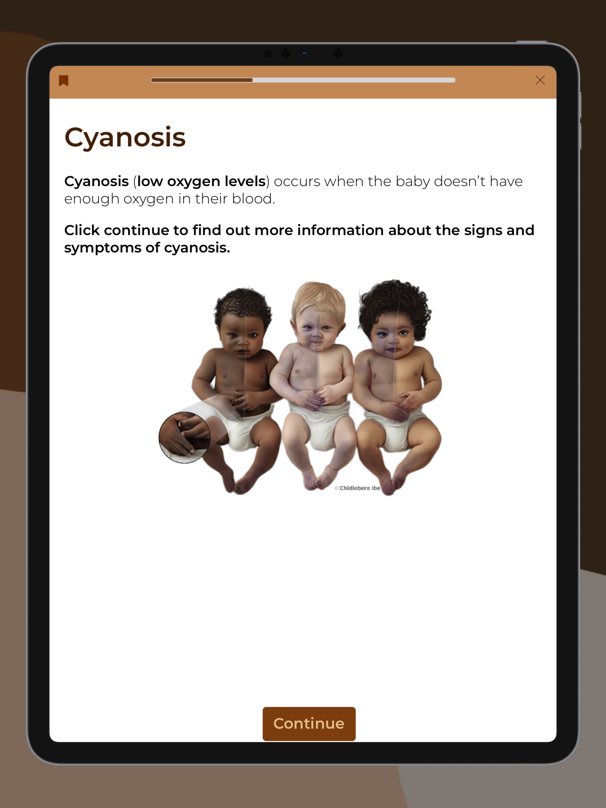 Melanatal