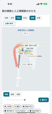 人工肩関節モデル のスクリーンショット