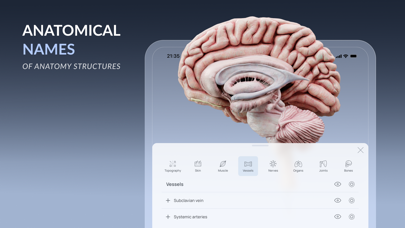 VOKA 3D Anatomy & Pathology Screenshot