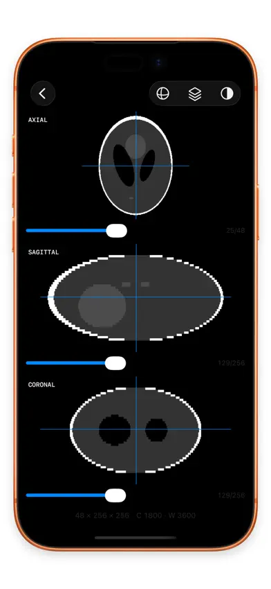 Lumen — DICOM viewer screenshot 2