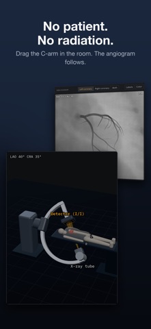 AngioView screenshot 5