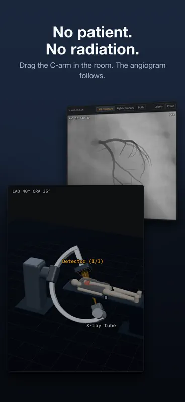 AngioView screenshot 5 of 5