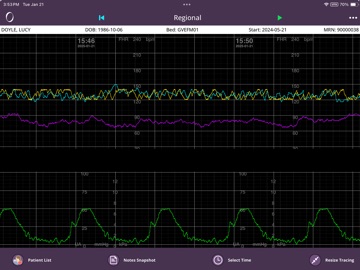 OBIX Mobility iPad screenshot