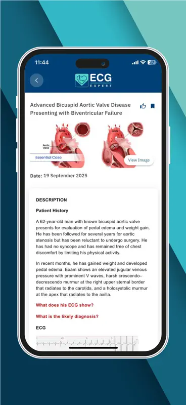 ECG Expert screenshot 2 of 4
