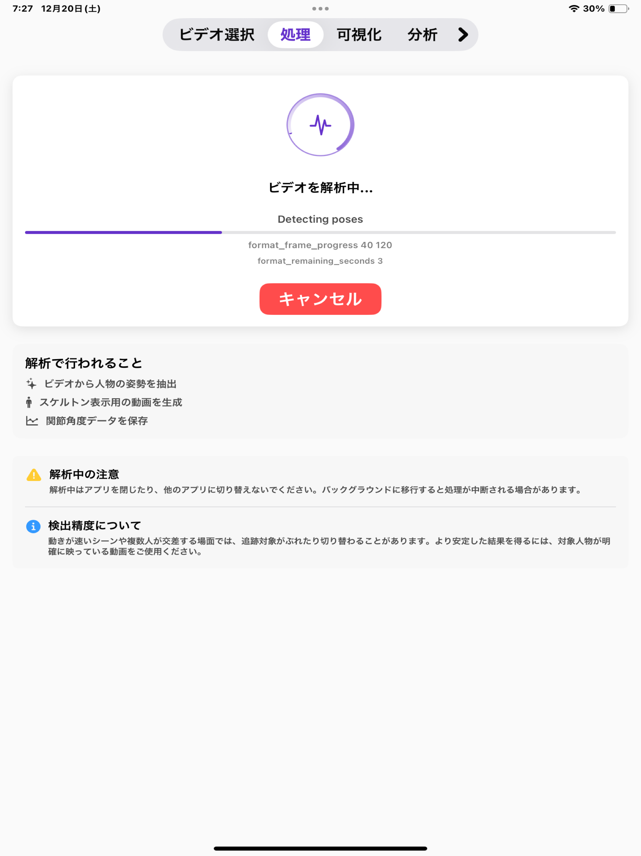 MoveScope