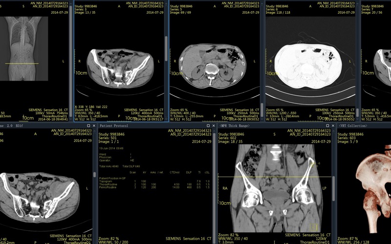 DICOM Viewer Pro Screenshot