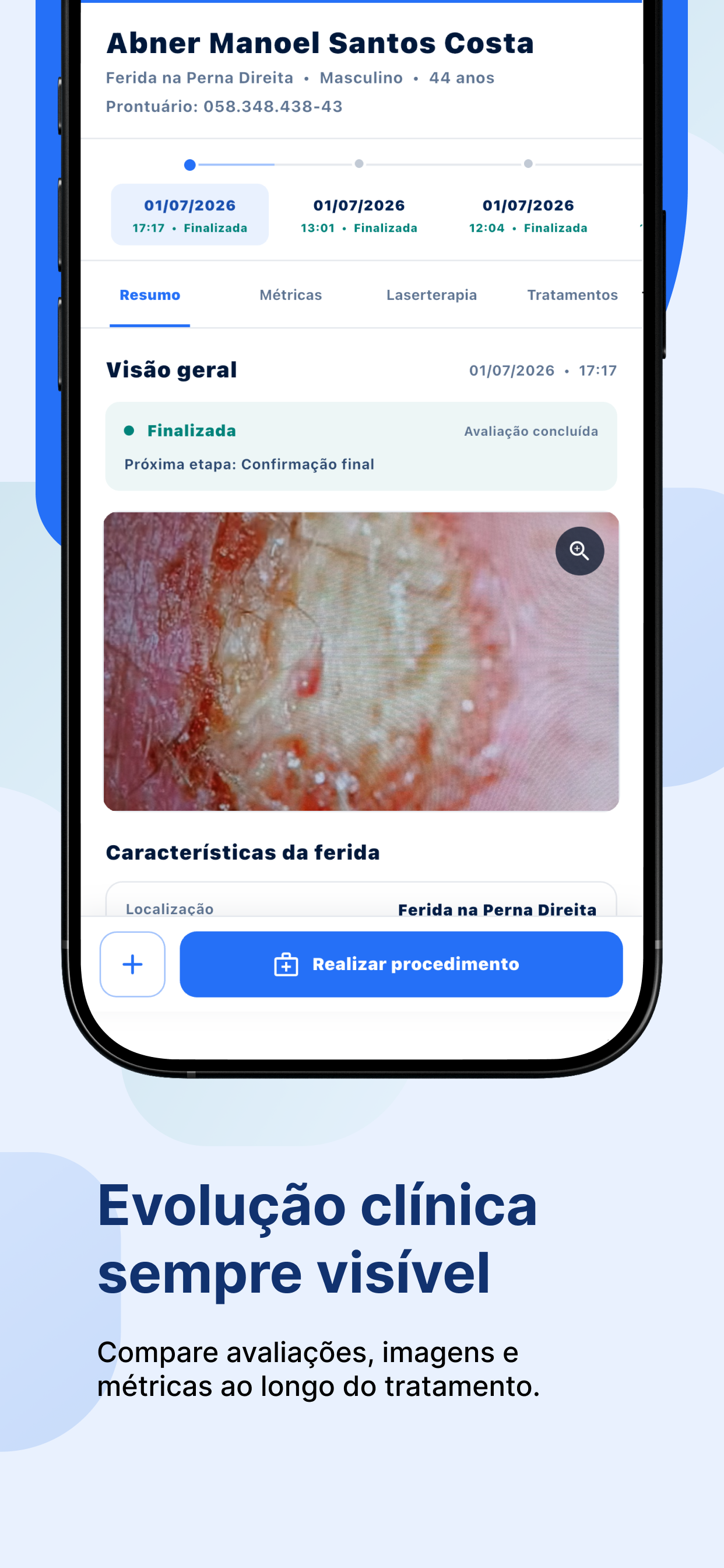 WoundCare: Cuidado de Feridas screenshot 4