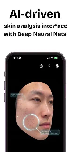 Skin AI - Acne Tracker screenshot 4