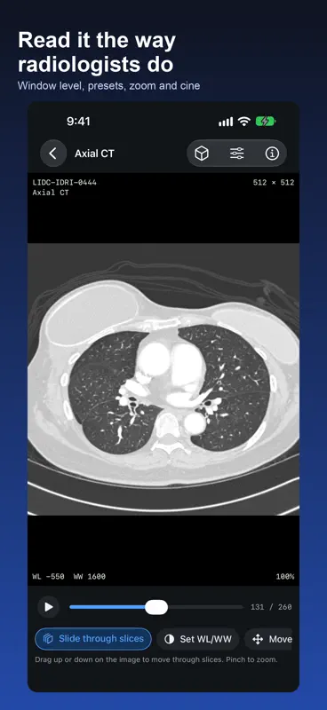 DICOM Viewer: DCM & MRI Reader screenshot 2 of 6