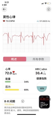 ECG 心电图 分析器 - Watch screenshot