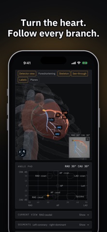 AngioView iPhone screenshot 2